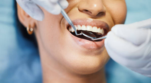 Best Emergency Root Canal Treatment in Perryton, TX