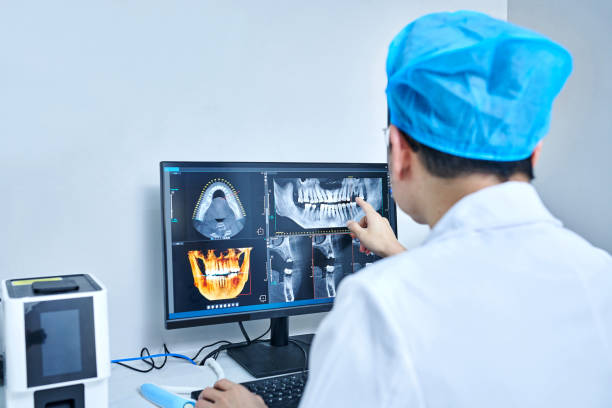 Best Emergency Tooth Extraction in Perryton, TX