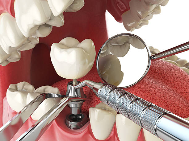 Best Weekend Emergency Dentist in Perryton, TX